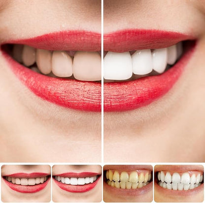 SP-4 Ultra+ Whitening Teeth Liquid form (Pack of 2)